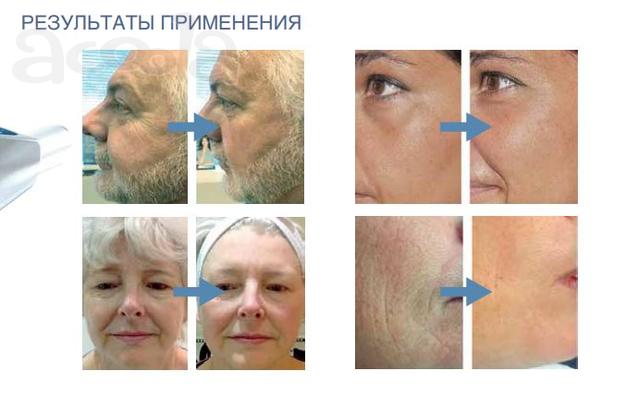 Косметологические услуги и профессиональная косметика